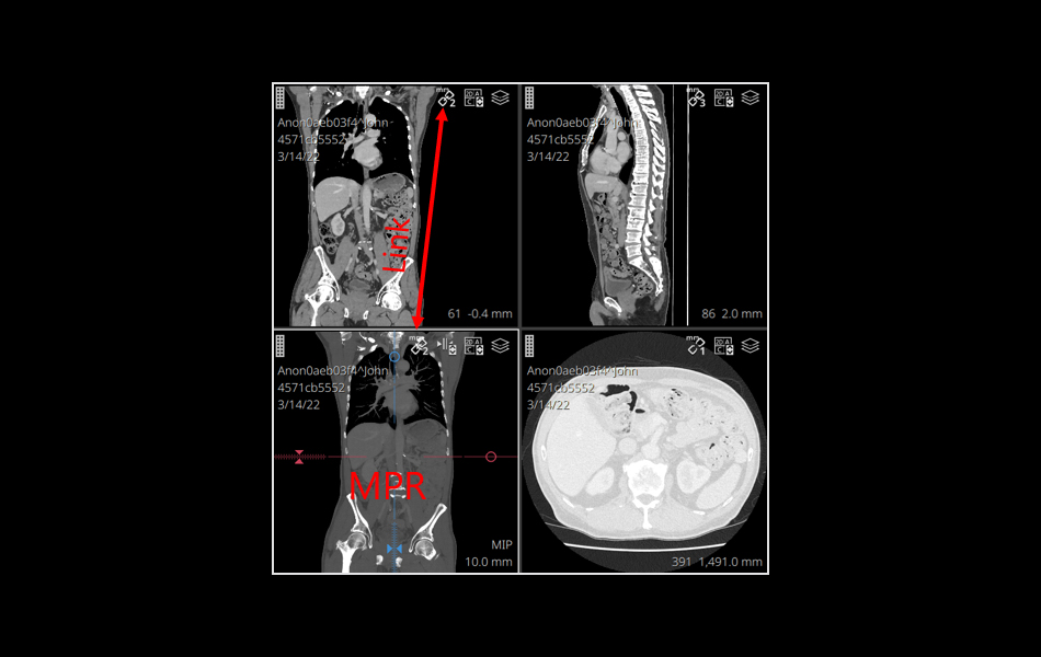MIP/MPR Linking image 1.