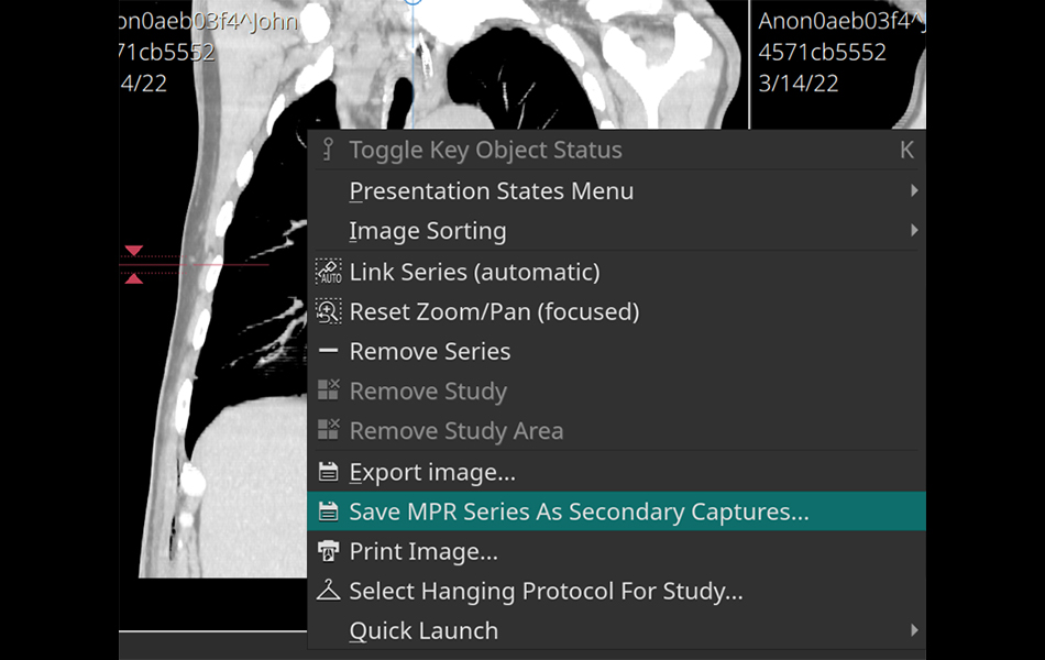 MPR Batch Export image 1.