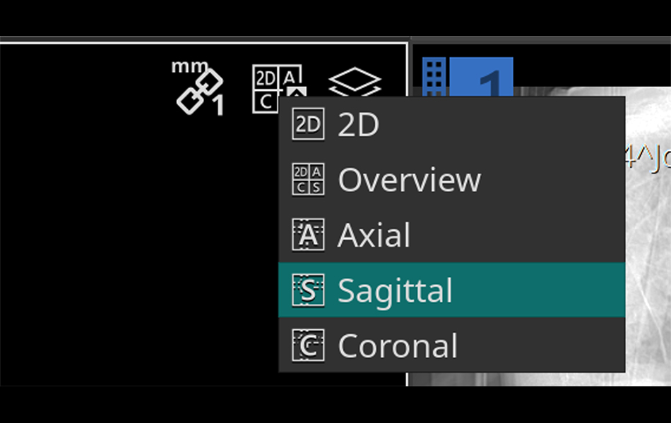 Other MPR improvements image 1.