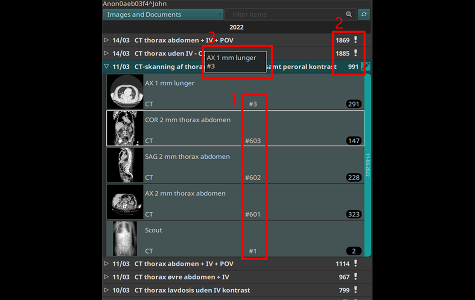 Patient study browser image 1.