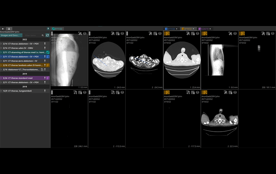 Patient Study Browser image 1.