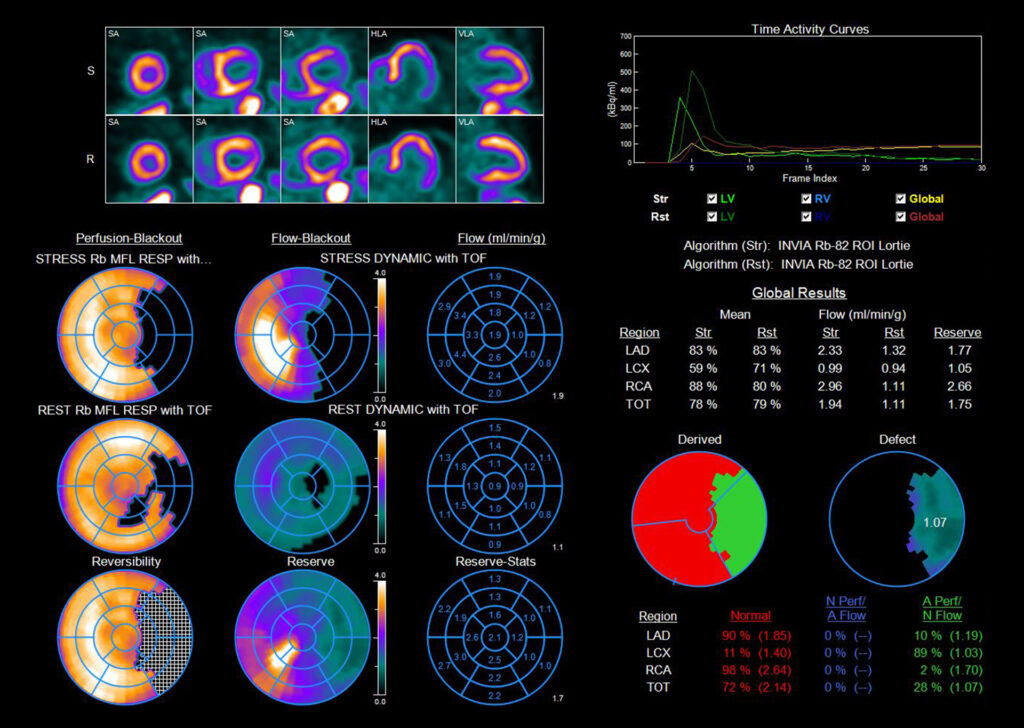 Advanced Clinical Workflows, Cardiology, 4DM image.