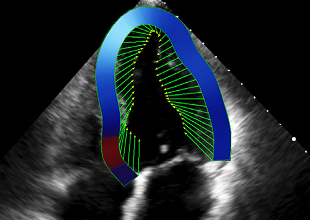 Advanced Clinical Workflows, Cardiology, TOMTEC image.