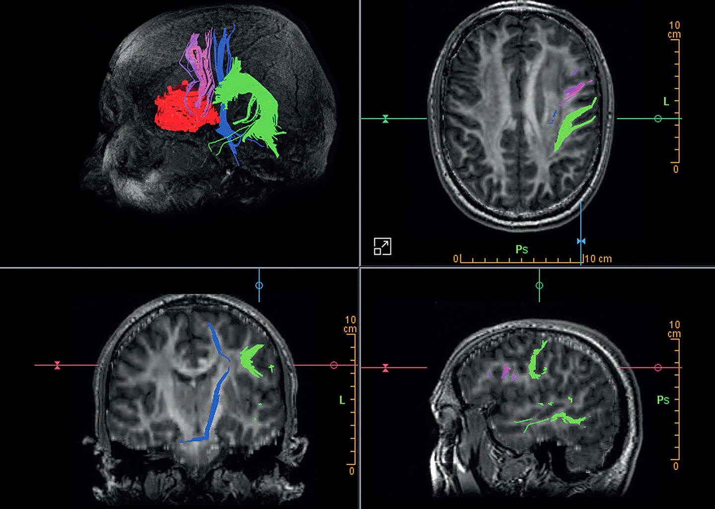 Clinical Pathways Neurology Functional MRI, Customer Newsletter.