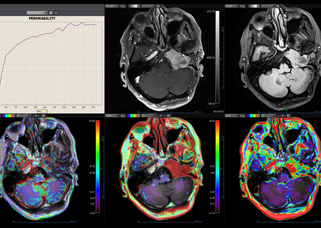 Advanced Clinical Workflows, Neurology, MR Head, Neck image.