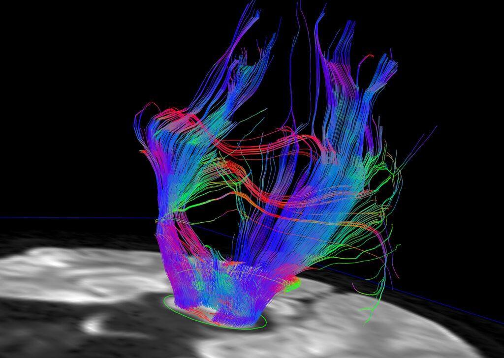 Advanced Clinical Workflows, Neurology, MR Neuro image.