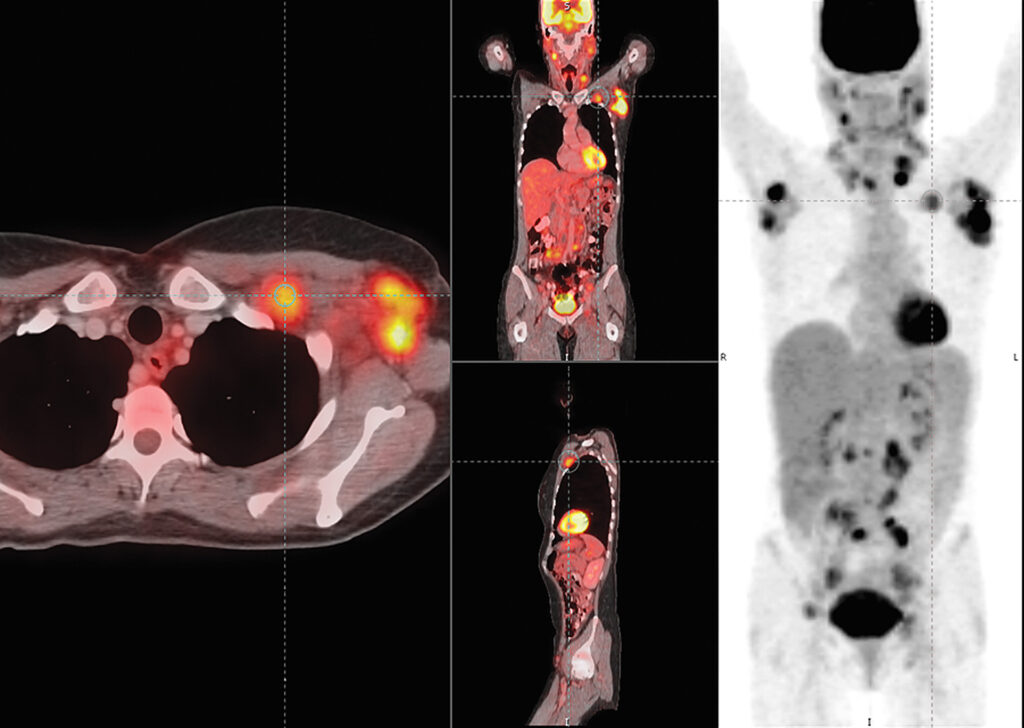 Advanced Clinical Workflows, Oncology, Mirada Oncology image.