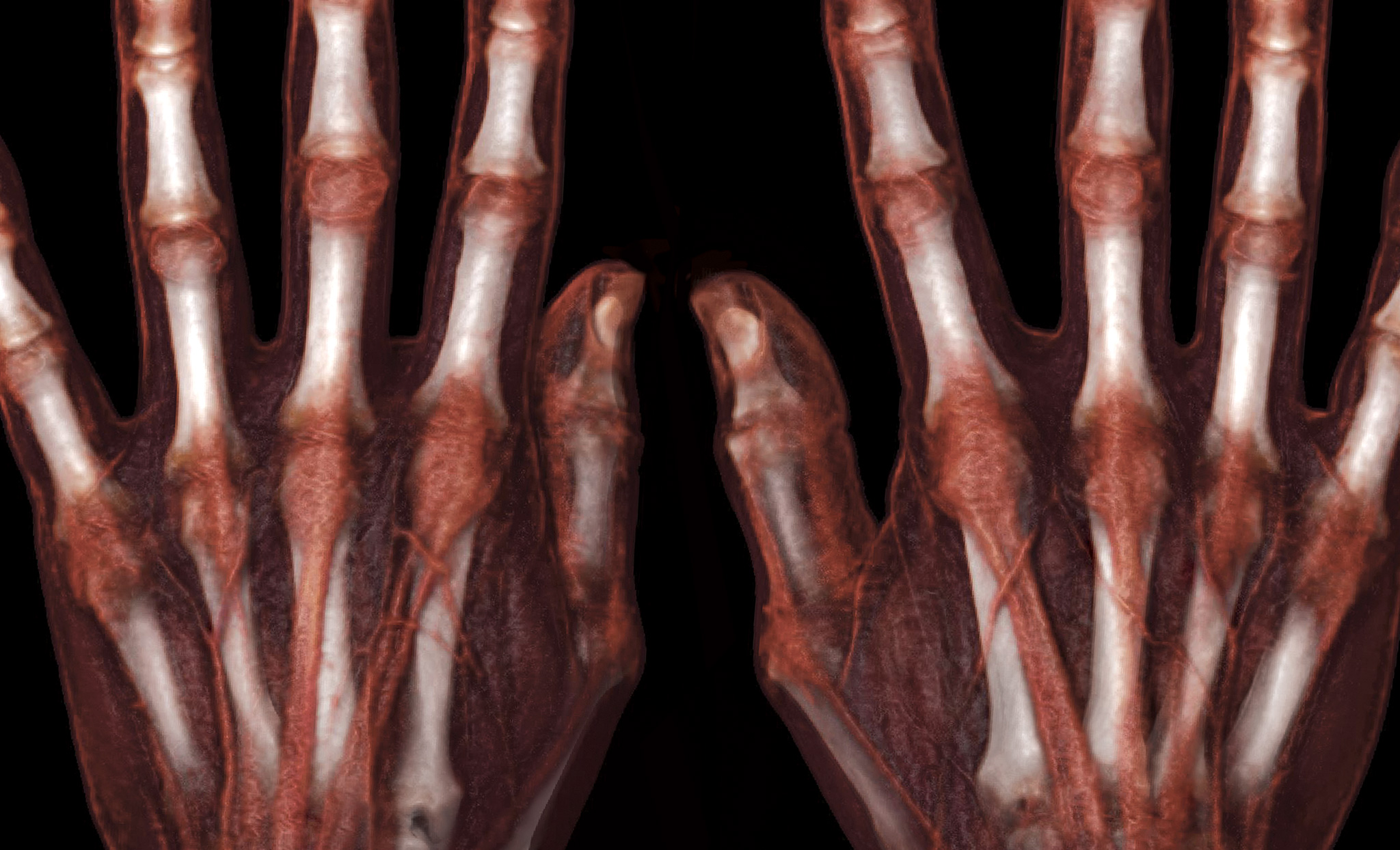 Clinical applications musculoskeletal intro banner image.