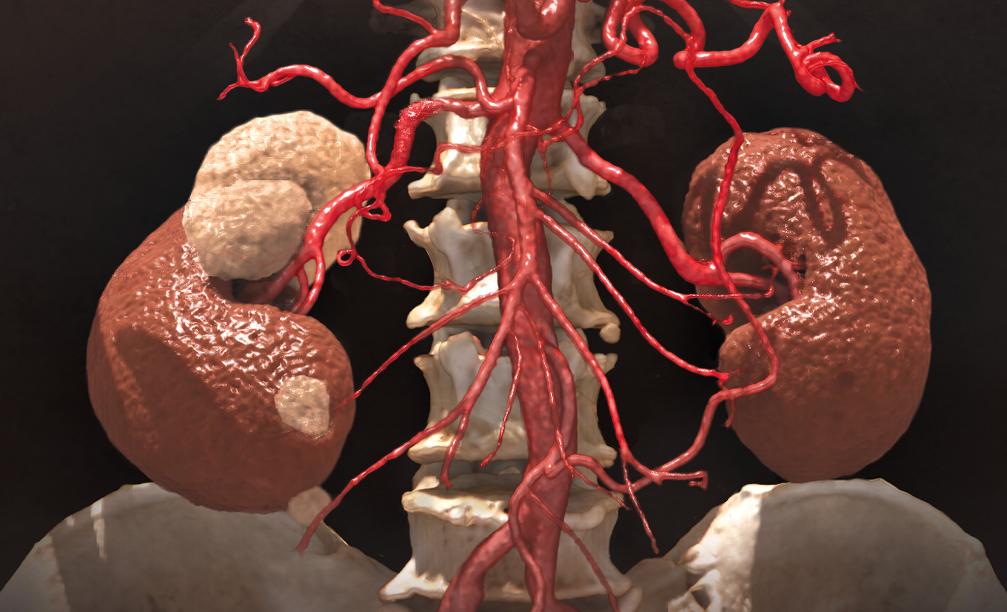 Clinical applications vascular interventional intro banner image.