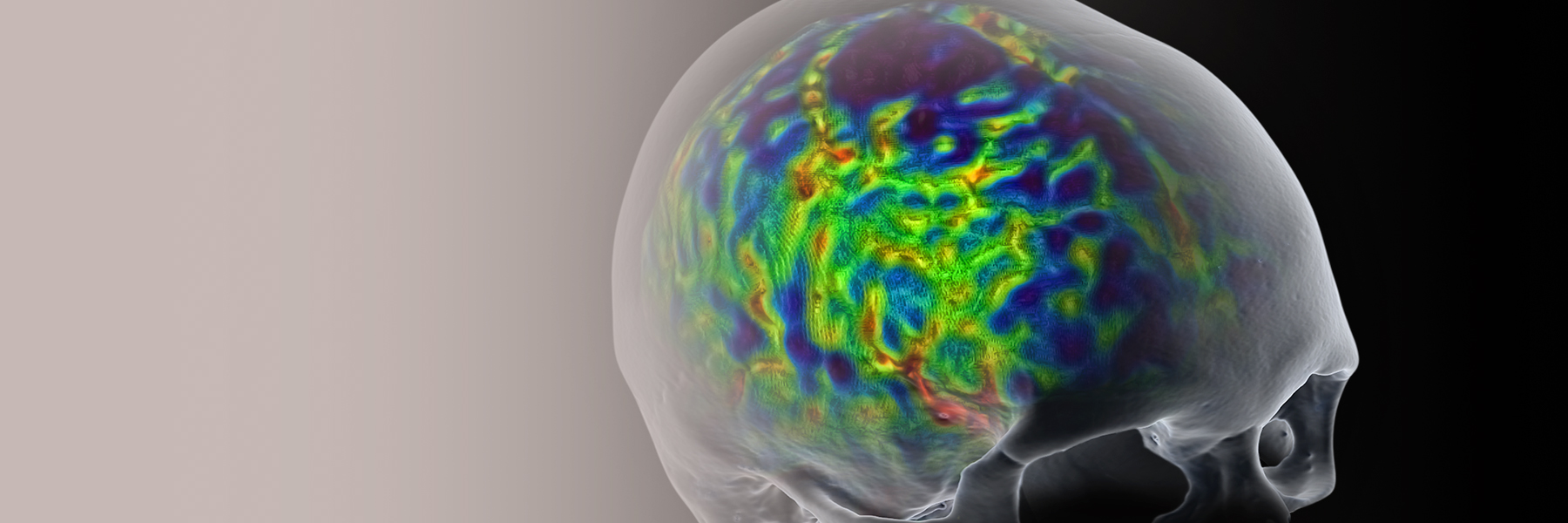 Neuro Imaging