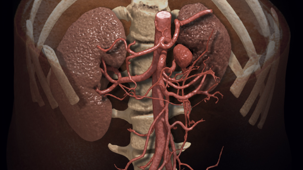 Advanced Clinical Workflows, Neuro, CT Renal image.