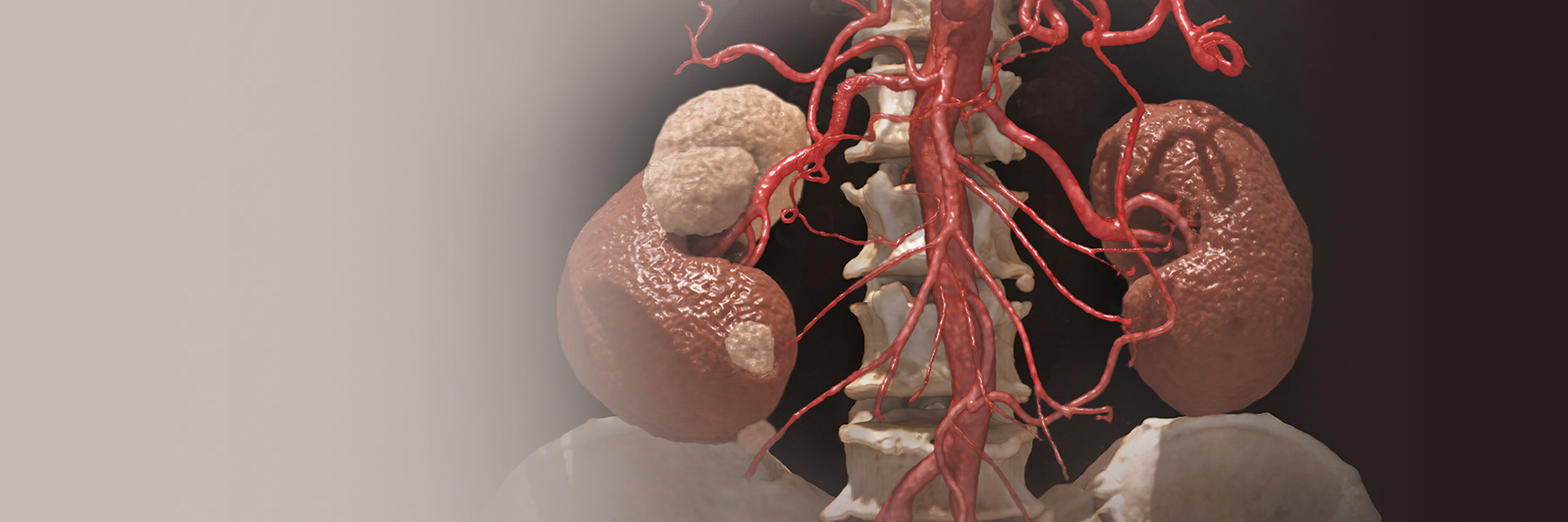 Vascular Imaging