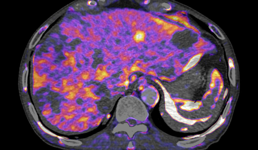 Advanced Clinical Workflows Home, Oncology photo.