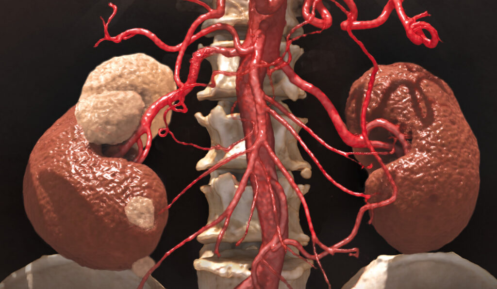 Clinical Applications Home, Vascular photo.