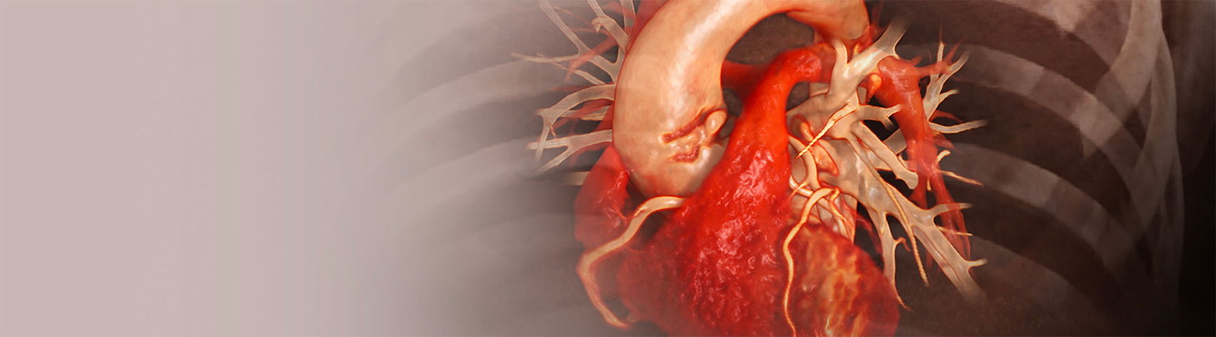 Cardiovascular Advanced Clinical Workflows