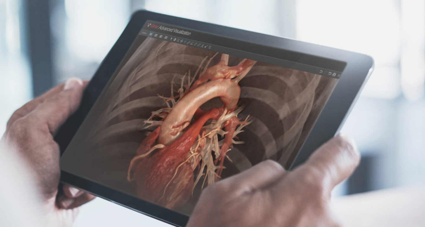 Vitrea Advanced Visualization displaying on an iPad.