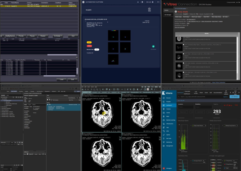 Vitrea® Enterprise Imaging Demonstration