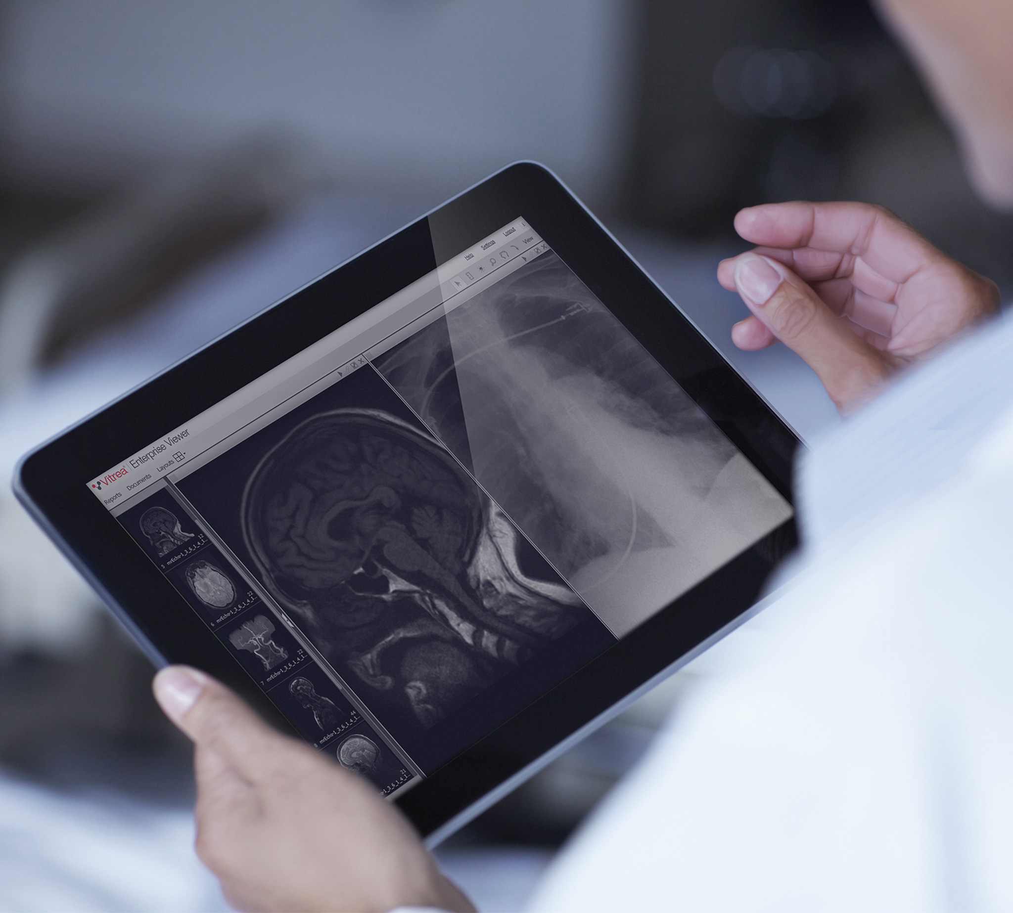 Doctor viewing diagnostic images on tablet.